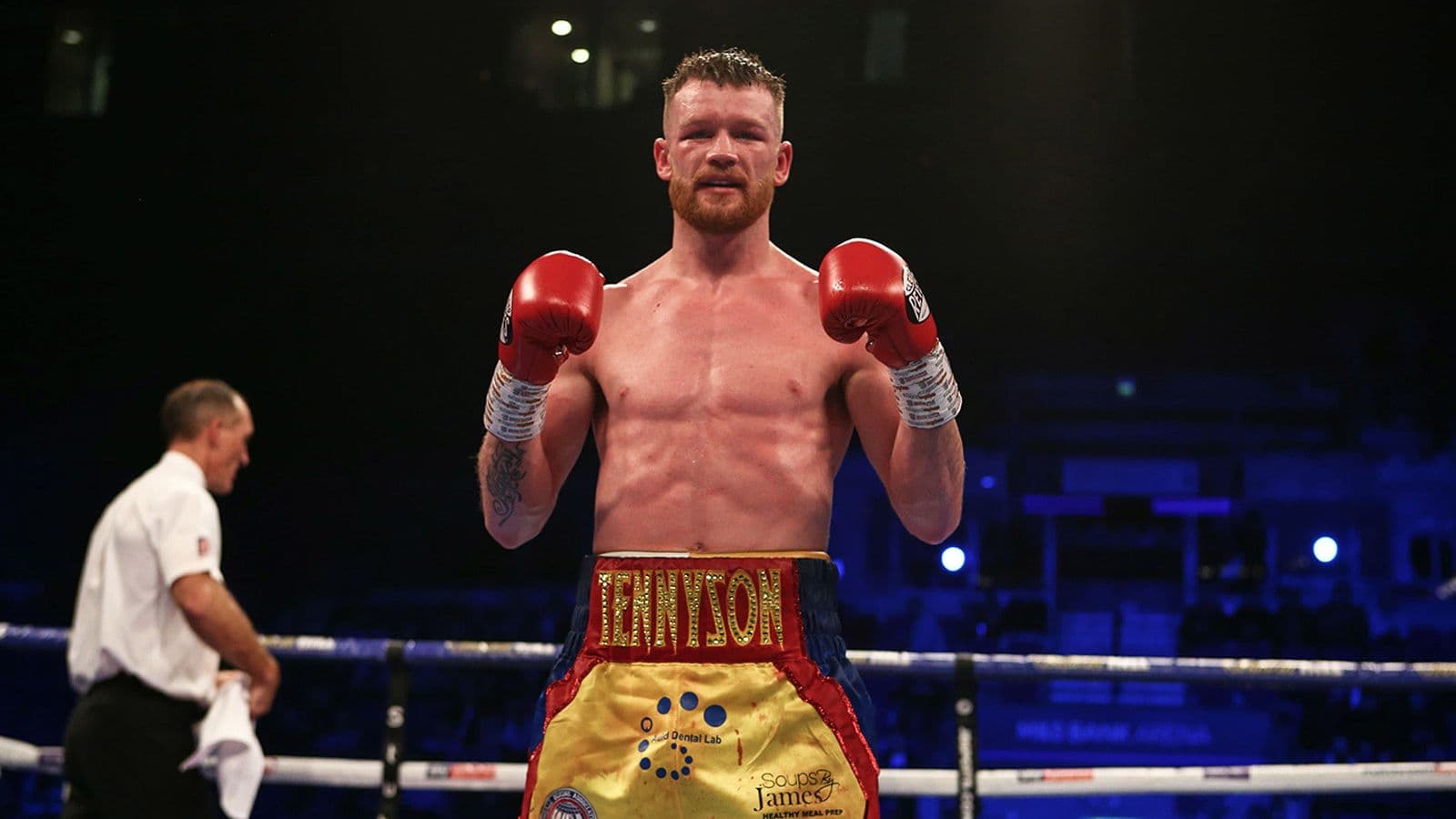 James Tennyson Yellow Shorts