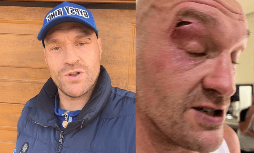 Tyson Fury Cut Montage