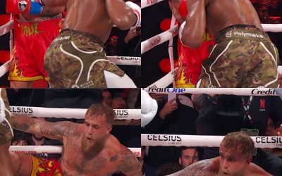 What are people saying about the Jake Paul vs Anthony Joshua result nakisa bidarian boxer cruiserweight broken jawbone surgery operation hospital bed